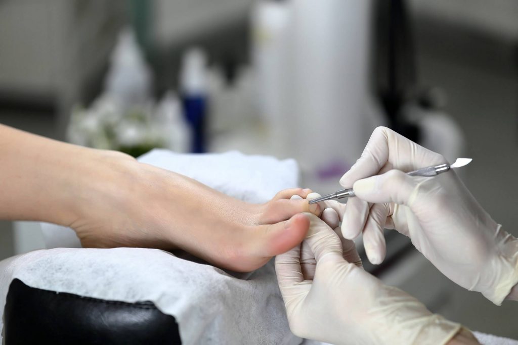 Pedicure